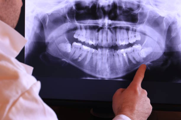 Best Emergency Tooth Extraction in , MI