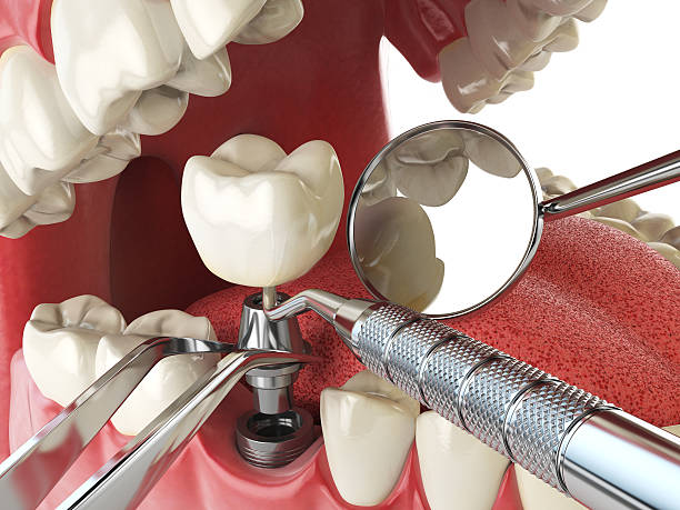 Best Emergency Dental Surgery in , MI